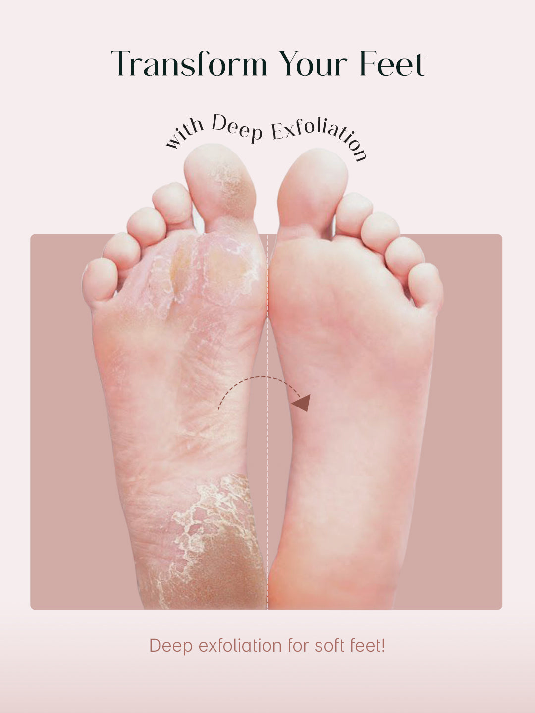 SeoulSkin Glycolic Acid Foot Peeling Mask Pack Of 2