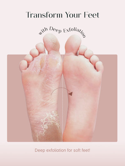 SeoulSkin Glycolic Acid Foot Peeling Mask Pack Of 2