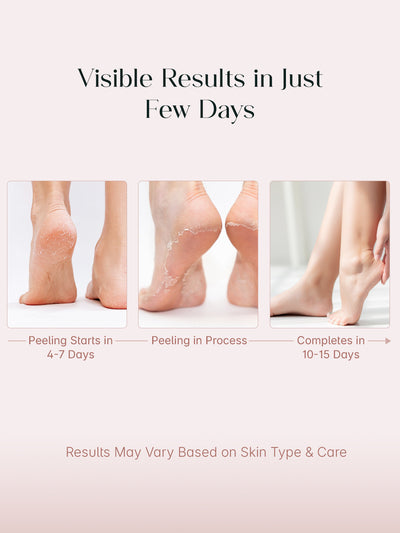 SeoulSkin Glycolic Acid Foot Peeling Mask Pack Of 2