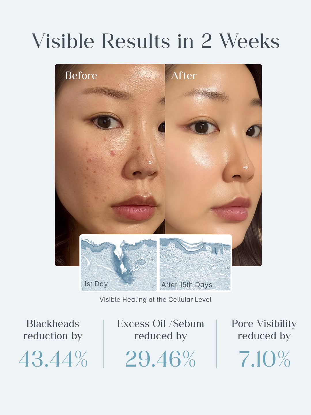 Seoulskin Zero Pore Pads