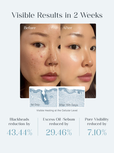 Seoulskin Zero Pore Pads